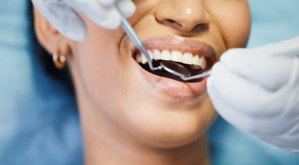 Best Pediatric Emergency Dentist in Brunswick, OH